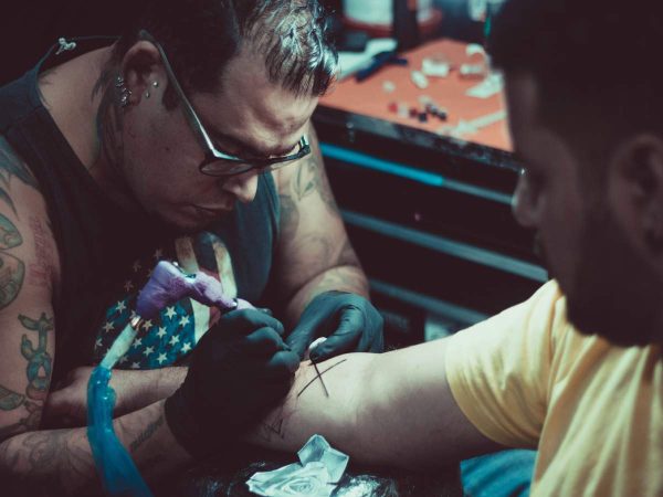 Tattoo Removal and Sun Exposure: Why Timing Matters