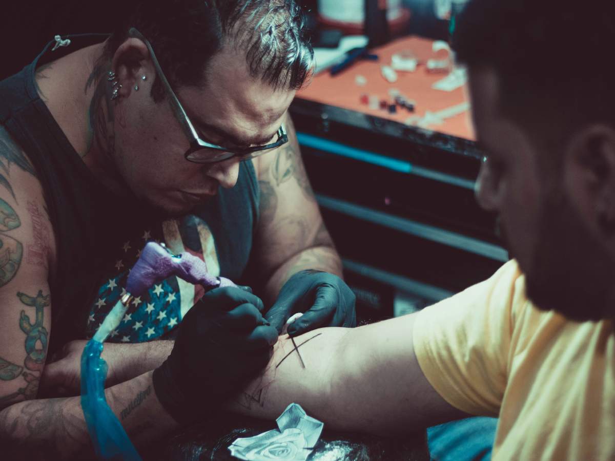 Tattoo Removal and Sun Exposure